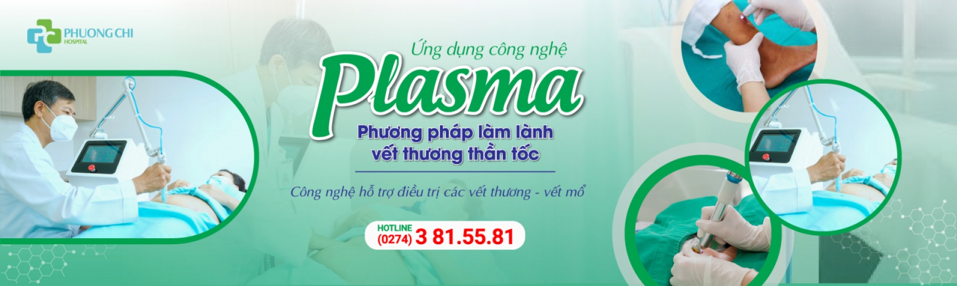 Ứng dụng công nghệ chiếu tia Plasma Bình Dương