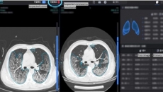 “Bác sĩ” AI này đang được sử dụng để chẩn đoán nhanh virus Corona